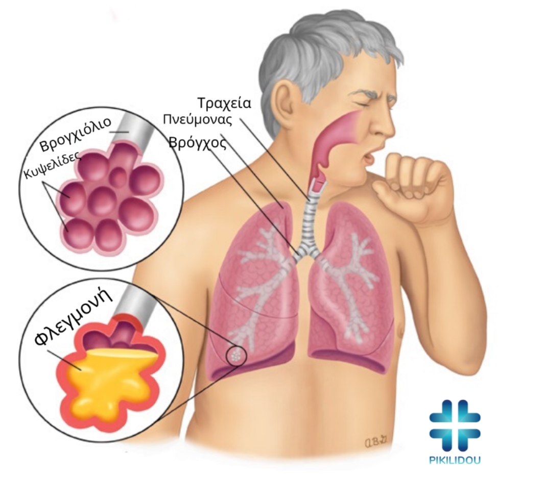Πληροφορίες για τη νόσο Covid-19 covid 19 simptomata