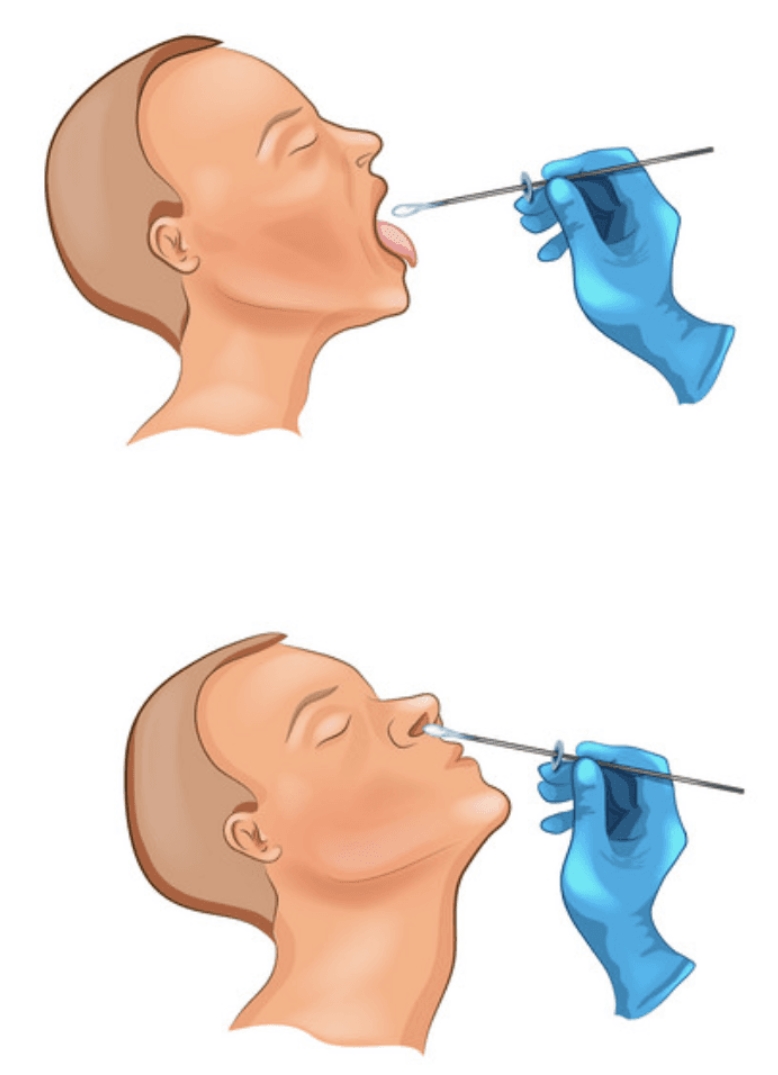 test corona virus pikilidou test corona virus pikilidou