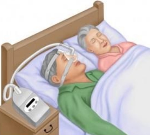 Υπνική άπνοια ως αιτία ανεξήγητης κόπωσης και υπέρτασης